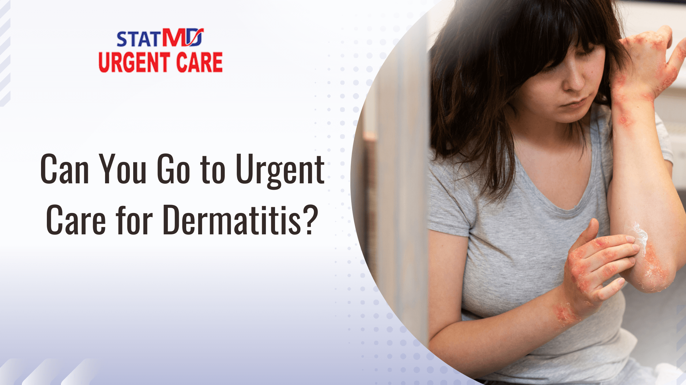 Can You Go to Urgent Care for Dermatitis