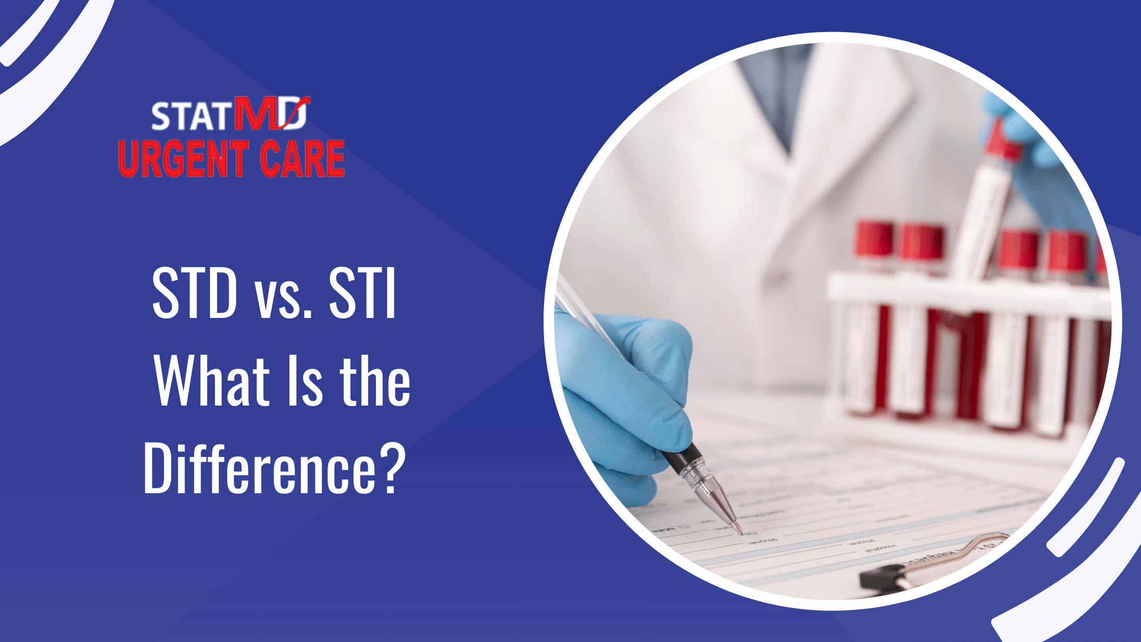 Difference between STD and STI